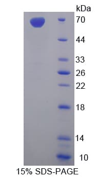 Rat EMA / MUC1 Protein (Recombinant His-GST-S)