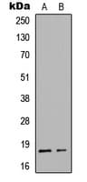 Polyclonal Rabbit anti-Human SNCA / Alpha-Synuclein Antibody (C-Terminus, IHC, IF, WB)