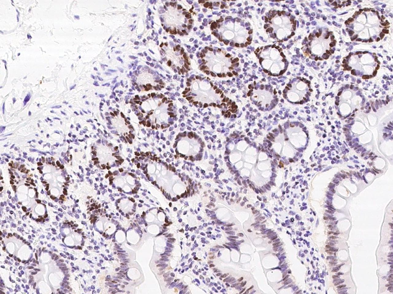 LIG1 / DNA Ligase 1 Antibody