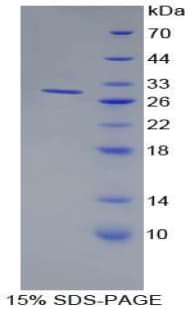 Human CD157 Protein (Recombinant His-T7)