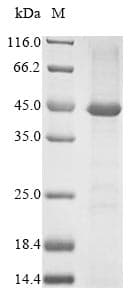 Human CD95 / FAS Protein (Recombinant 10His, N-terminus)