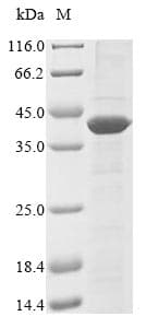 Methanobacterium ivanovii nifH1 Protein (Recombinant 10His, N-terminus + Myc, C-terminus)