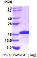 Human MDK / Midkine Protein (Recombinant His)