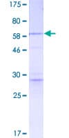 Human CASP3 / Caspase 3 Protein (Recombinant GST)