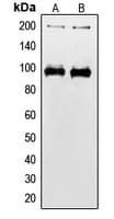 IGF1R / IGF1 Receptor Antibody (phospho-Tyr1165/Tyr1166)