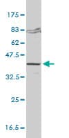 FVT1 / KDSR Antibody (clone 2B2-3C11)