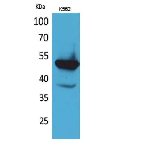 PROC / Protein C Antibody (181-230 aa, Internal)
