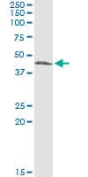 Monoclonal Mouse anti-Human CTH / Cystathionase Antibody (clone 4E1-1B7, WB)