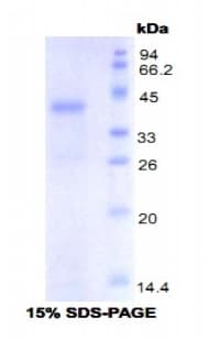 Mouse TLR4 Protein (Recombinant His, N-Terminal)