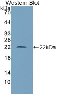 CD68 Antibody (aa27-303)