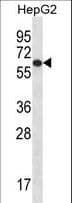 TBC1D22A Antibody (aa447-476)