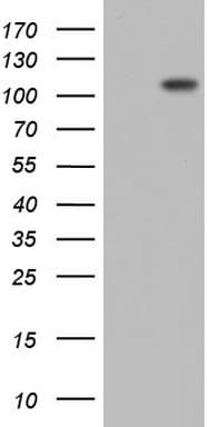Monoclonal Mouse anti-Human PLOD2 Antibody (clone OTI6D1, aa359-640, WB)