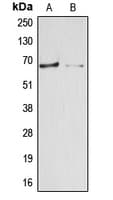 ARSE / Arylsulfatase E Antibody (Internal)