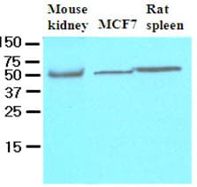 Monoclonal Mouse anti-Human CFLAR / FLIP Antibody (clone 5D8, aa1-376, WB)