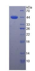 Human CFH / Complement Factor H Protein (Recombinant His)