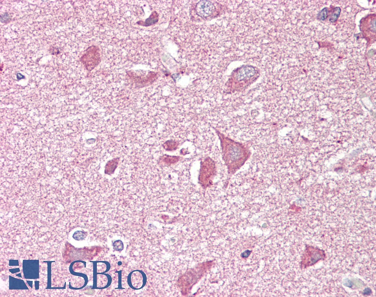 IHC-plus™ Polyclonal Goat anti-Human NCAM2 Antibody (aa822-836, IHC)
