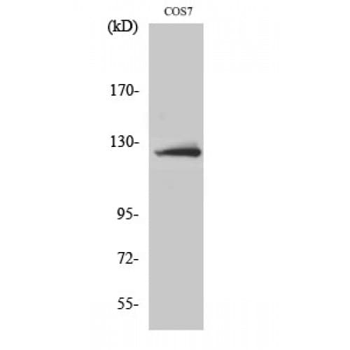 ACLY / ATP Citrate Lyase Antibody (390-470 aa)