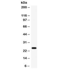 Polyclonal Rabbit anti-Human WFDC2 / HE4 Antibody (WB)