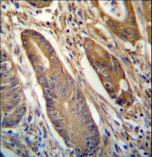 IHC-plus™ NETO2 Antibody (aa174-203)