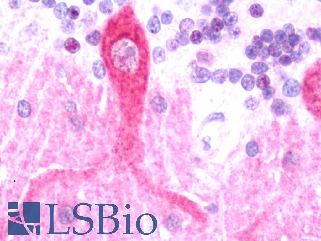 IHC-plus™ ANGPTL3 Antibody