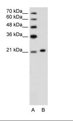Polyclonal Rabbit anti-Human ANK1 / Ankyrin Antibody (C-Terminus, IHC, WB)