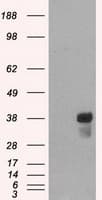 CD2 Antibody (clone OTI4E4)