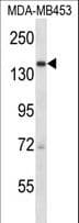 URB2 Antibody (aa1495-1524)
