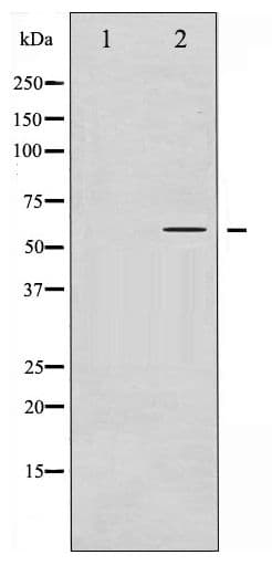 IRF3 Antibody (phospho-Ser385)