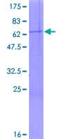 Human IGFBP2 / IGF-BP53 Protein (Recombinant GST)