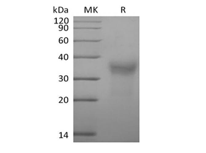 Cynomolgus CD7 Protein (Recombinant 6His, C-terminus)