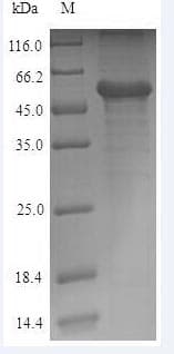 Human CALR / Calreticulin Protein (Recombinant 6His, N-terminus)
