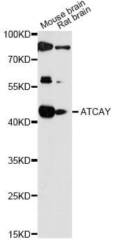 Polyclonal Rabbit anti-Human ATCAY / CLAC Antibody (WB)