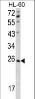 NME4 Antibody (aa158-187)