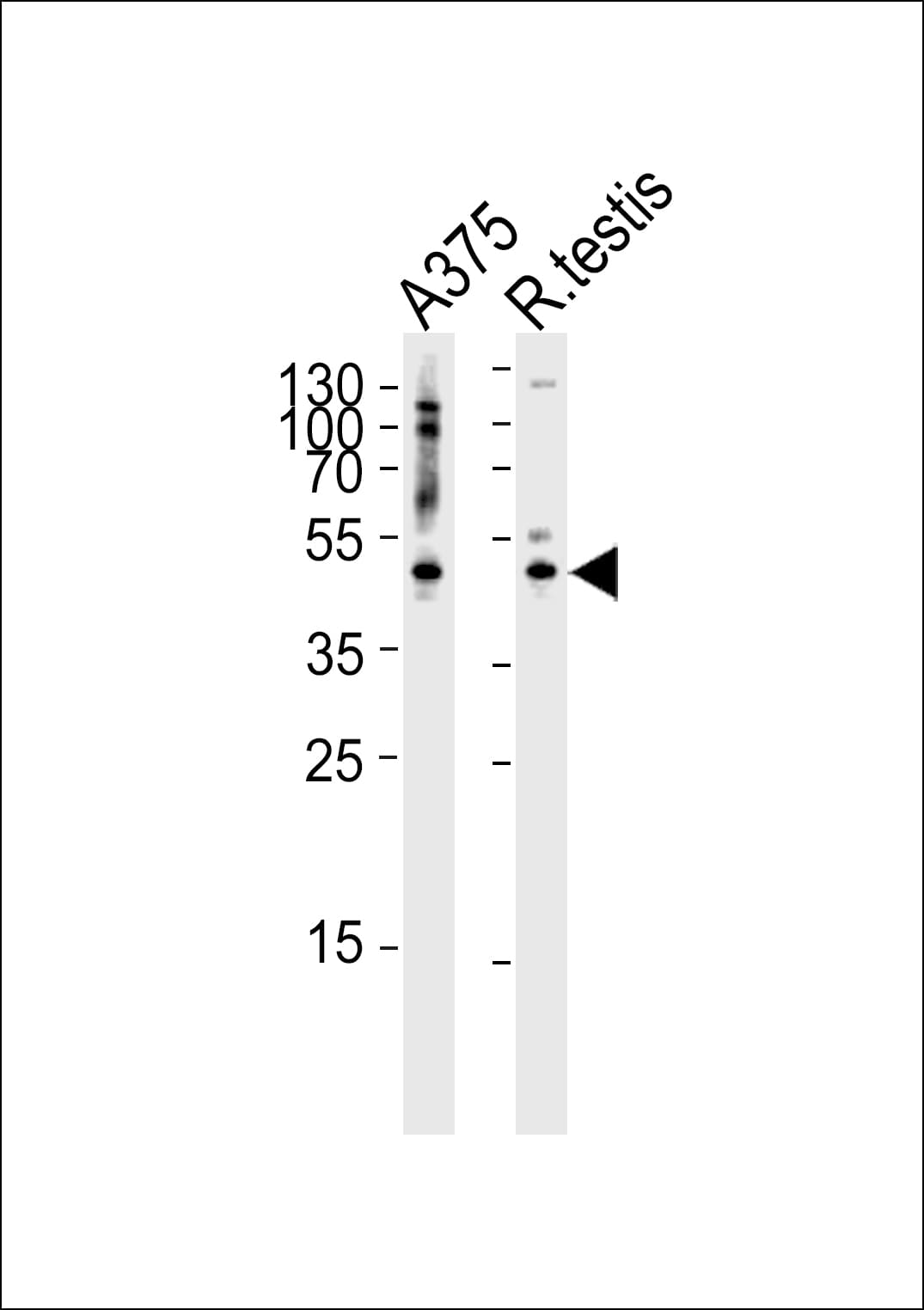AP1M1 Antibody (aa199-227)
