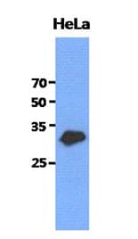 GCLM Antibody (clone AT2D12)