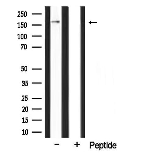 CLASP1 Antibody
