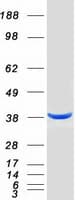 Human DFFA / ICAD / DFF45 Protein (Recombinant Myc-DDK (Flag))