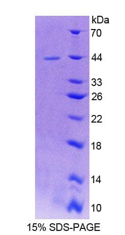 Mouse ERI1 / HEXO Protein (Recombinant His-T7, N-terminus)