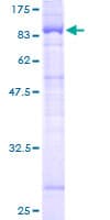 Human SHOC2 Protein (Recombinant GST)