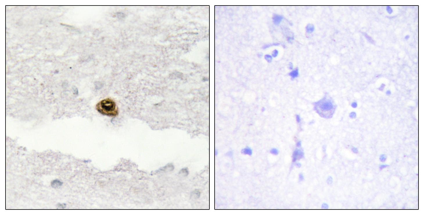 DGKZ Antibody