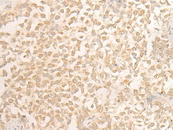 Polyclonal Rabbit anti-Human DUSP27 Antibody (IHC)