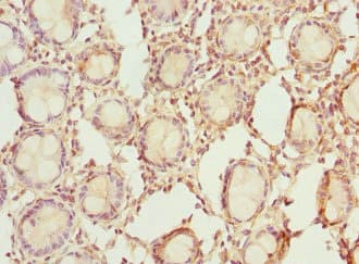 RDH1 / RDH5 Antibody