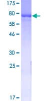 Human GAD65 Protein (Recombinant GST)