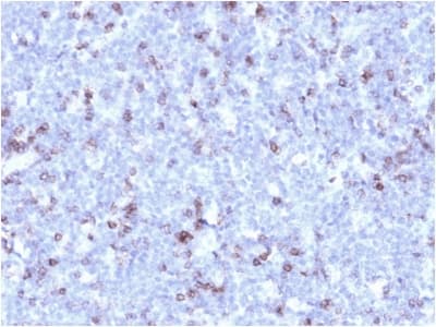 Recombinant Monoclonal Mouse anti-Human SPN / CD43 Antibody (clone rSPN/1094, IHC, IF, WB)