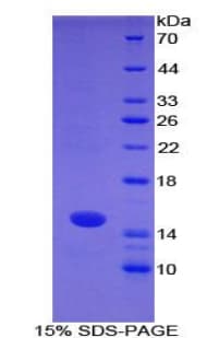 Mouse S100A7 / Psoriasin Protein (Recombinant His)