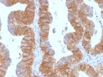 Monoclonal Mouse anti-Human EPCAM Antibody (clone EGP40/1384, Azide-free,BSA-free, IHC, IF)