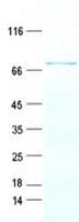 Human KY Protein (Recombinant His, N-Terminal)