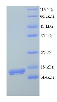 Human MLANA / Melan-A Protein (Recombinant 6His, N-terminus)