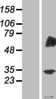 TRIM4 / RNF87 Protein (Over-Expression Lysate Myc-DDK (Flag))