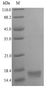 Human Oxytocin Protein (Recombinant 6His, N-terminus)